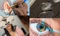 What is Astigmatism Treatment?