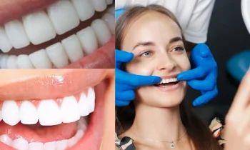 Zirkonyum Diş Kaplama Hizmetlerinde Kalite Standartları Neden Önemlidir?